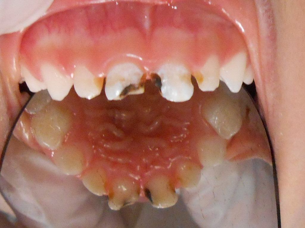 Before